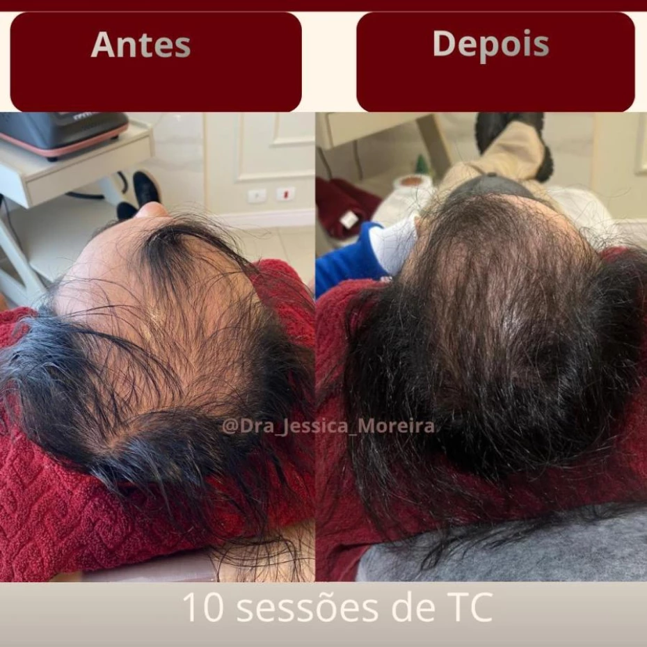 Foto 4:  —  Clínica Dra. Jessica Moreira Saúde e Estética Especializada