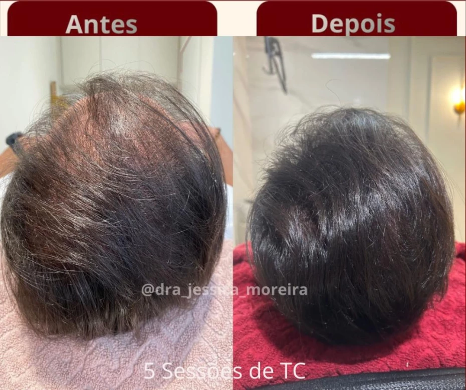 Foto 3:  —  Clínica Dra. Jessica Moreira Saúde e Estética Especializada